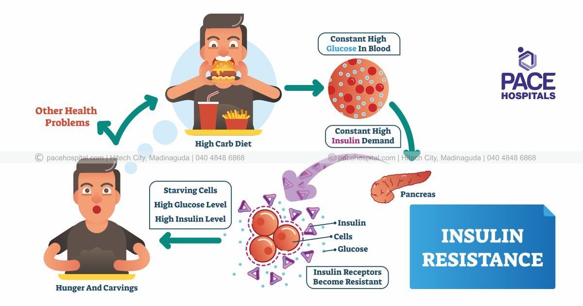 Insulin Resistance a cause of worry for pre diabetic diabetic